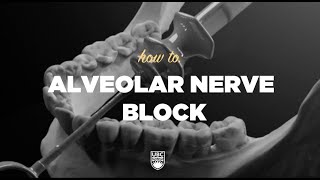 How To  Alveolar Nerve Block ubcmedicine ubcdentistry [upl. by Sammy862]