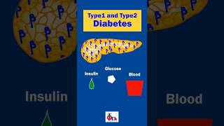 Type1 and Type 2 Diabetes  Know the difference DrTulip  JP Nagar [upl. by Osyth]