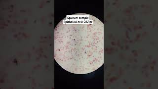 Sputum gramstain infection microscope drmicro [upl. by Hoshi289]