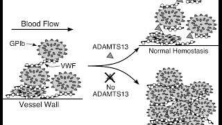 Thrombotic Thrombocytopenic Purpura TTP [upl. by Dragone]