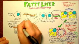 Fatty Liver Pathophysiology [upl. by Akimal371]