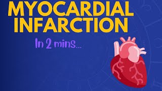 Myocardial Infarction in 2 mins [upl. by Leinehtan10]