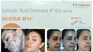 SALICYLIX SF12 Ointment Cream Salicylic Acid Ointment IP 12 ww [upl. by Euqinom]