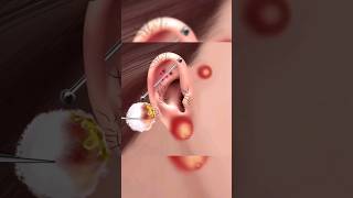 ASMR  Ear cleaning and Earwax removal asmrshorts asmranimation ears treatment [upl. by Stambaugh]