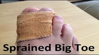 Turf Toe amp Sprained Big Toe BEST Home Treatment [upl. by Guthry71]