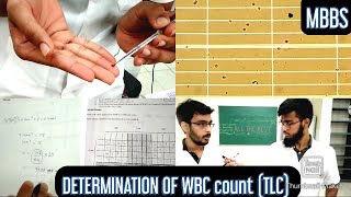 Determination of WBC count TLC Total leucocyte count  MUHS  mbbs practical hematology [upl. by Eerpud]