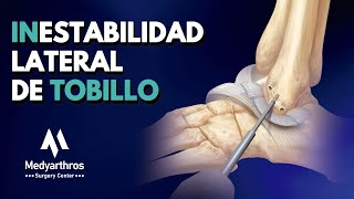 Inestabilidad Lateral de Tobillo [upl. by Ayanahs]