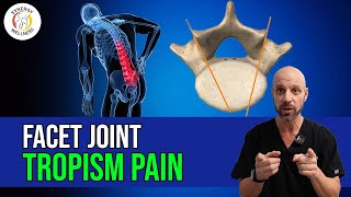 Facet Joint Tropism Pain [upl. by Milzie]