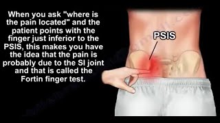 The painful sacroiliac Joint why it Hurts [upl. by Jared966]