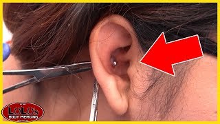 This Conch Piercing Looks BAD Removal [upl. by Ednil]