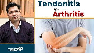 Tendonitis Vs Arthritis What Is The Difference  Types of Tendonitis  TimesXP [upl. by Lawford]