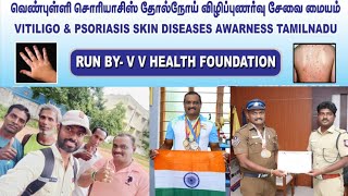 வெண்புள்ளி உள்ள நண்பர்கள் ஒன்று கூடும் முதல் நிகழ்ச்சி  Vitiligo Motivation Tamil [upl. by Somar]