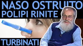 Dott Mozzi Naso ostruito polipi nasali turbinati rinite sinusite [upl. by Pontone298]