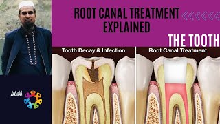 Root Canal Treatment Explained DentalDigest DEVKeFacts viralhog [upl. by Sassan]