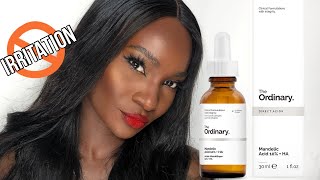 THE ORDINARY MANDELIC ACID  HA  HOW TO USE  REVIEW [upl. by Bagger79]