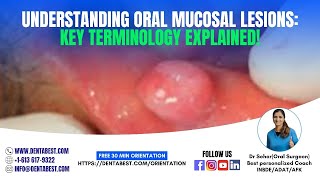 TERMINOLOGYORAL MUCOSAL LESIONS [upl. by Ddat]