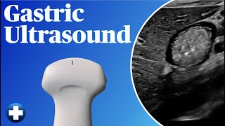 Gastric Ultrasound Gastric POCUS [upl. by Eerased462]