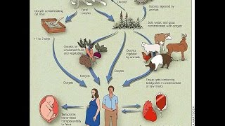 Congenital Toxoplasmosis [upl. by Beaumont]