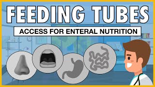 Types of Feeding Tubes EXPLAINED [upl. by Havelock]