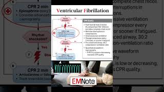 Ventricular Fibrillation VFib [upl. by Kryska101]