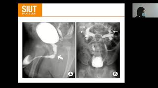 Urological investigation 03 Cystogram Urethrogram Antrograde Transrectal Ultrasound [upl. by Poliard]