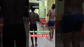 varicose vein varicosevein medical sscgdpreparation premedical armymedical shorts army [upl. by Arraes]