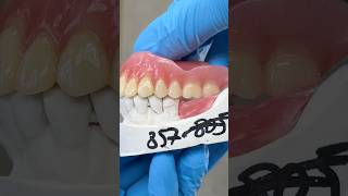 Upper Denture and Lower Posterior Bite Block lsk121shorts dentist teeth [upl. by Eirroc889]