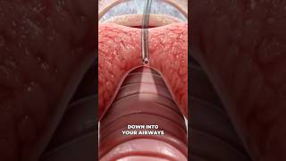 Bronchoscopy 3D Animation [upl. by Adnema]