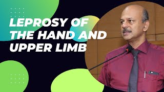 Leprosy and the hand  How the nerves are involved and what are the treatment options [upl. by Pooi]