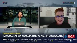 Importance of postmortem facial photography [upl. by Adnalro]