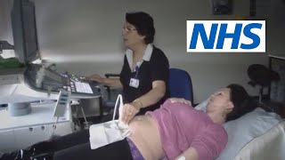 What happens at a scan and what will they tell me  NHS [upl. by Yessydo]