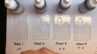 ABO Blood Typing Vid6 Samples HCSP21 [upl. by Aran]