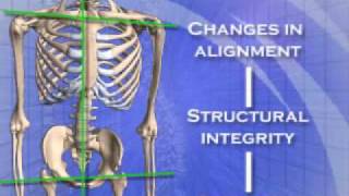 Chiropractor Goldsboro NC  Atlas Orthogonal Chiropractic Specialty at Chiropractic First [upl. by Auhso]