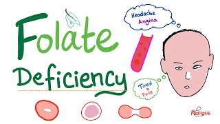 Folate deficiency  Megaloblastic Anemia  Macrocytic  Hematology Series [upl. by Atsok]