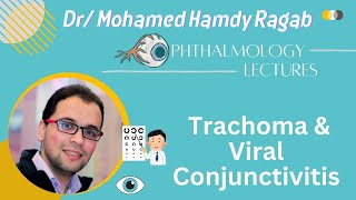 Conj 2 Trachoma amp Viral Conjunctivitis [upl. by Anjali669]