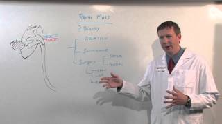 Treatments for Kidney Tumors  Kenneth Nepple MD [upl. by Dominick]