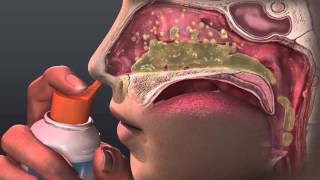 Can Saline Irrigation Help Nasal Allergies Animated Guide to Saline Nasal Irrigation [upl. by Hegarty939]