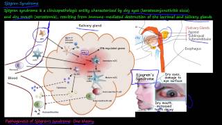 101P  What is Sjögren Syndrome [upl. by Doralyn200]