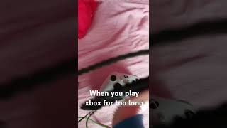 When u play xbox for too long [upl. by Bridgette634]