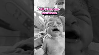 VBAC Delivery needs determination drkshilpireddy successfulvbac vbacbaby bestgynecologist [upl. by Anialeh535]