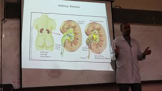 Gout and Hyperuricemia By Dr Dheyaa Jabbar [upl. by Atinauq]