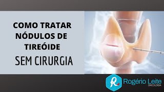 Como Tratar Nódulo De Tireoide Sem Cirurgia Dr Rogério Leite [upl. by Zeke604]