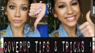 How To CoverUp Acne Spots My Tips amp Tricks [upl. by Levey]