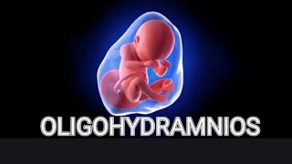 Oligohydramnios in Urdu  پانی کی کمی  Low AFI ultrasound  Pregnancy men baby water ki kami [upl. by Uile]