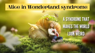 Alice in Wonderland syndrome  A syndrome that makes the world look weird [upl. by Pylle611]