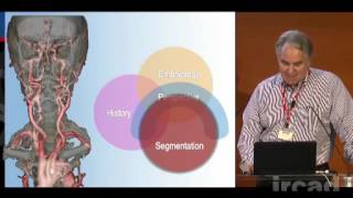 Internal carotid artery  neuroanatomical perspectives and surgical considerations [upl. by Anastos]