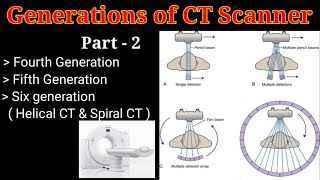 Ganerations of CT scanner  Part  2  Computed Tomography   By BL Kumawat [upl. by Latini]