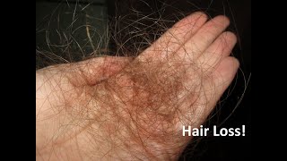 Doctor Discusses Most Common Cause of Sudden Hair Loss [upl. by Whitelaw868]