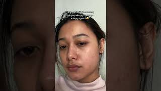 buah kesabaran🥲  avoskin retinol serum reviewavoskin retinol fungsi [upl. by Nioe]