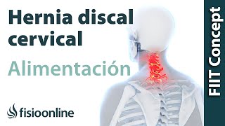 Hernia discal cervical derecha Alimentación nutrición y modificaciones en la dieta [upl. by Ahtebat]